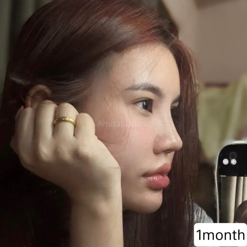 รีวิวทรงจมูก
