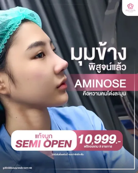 ทรงจมูกโด่ง