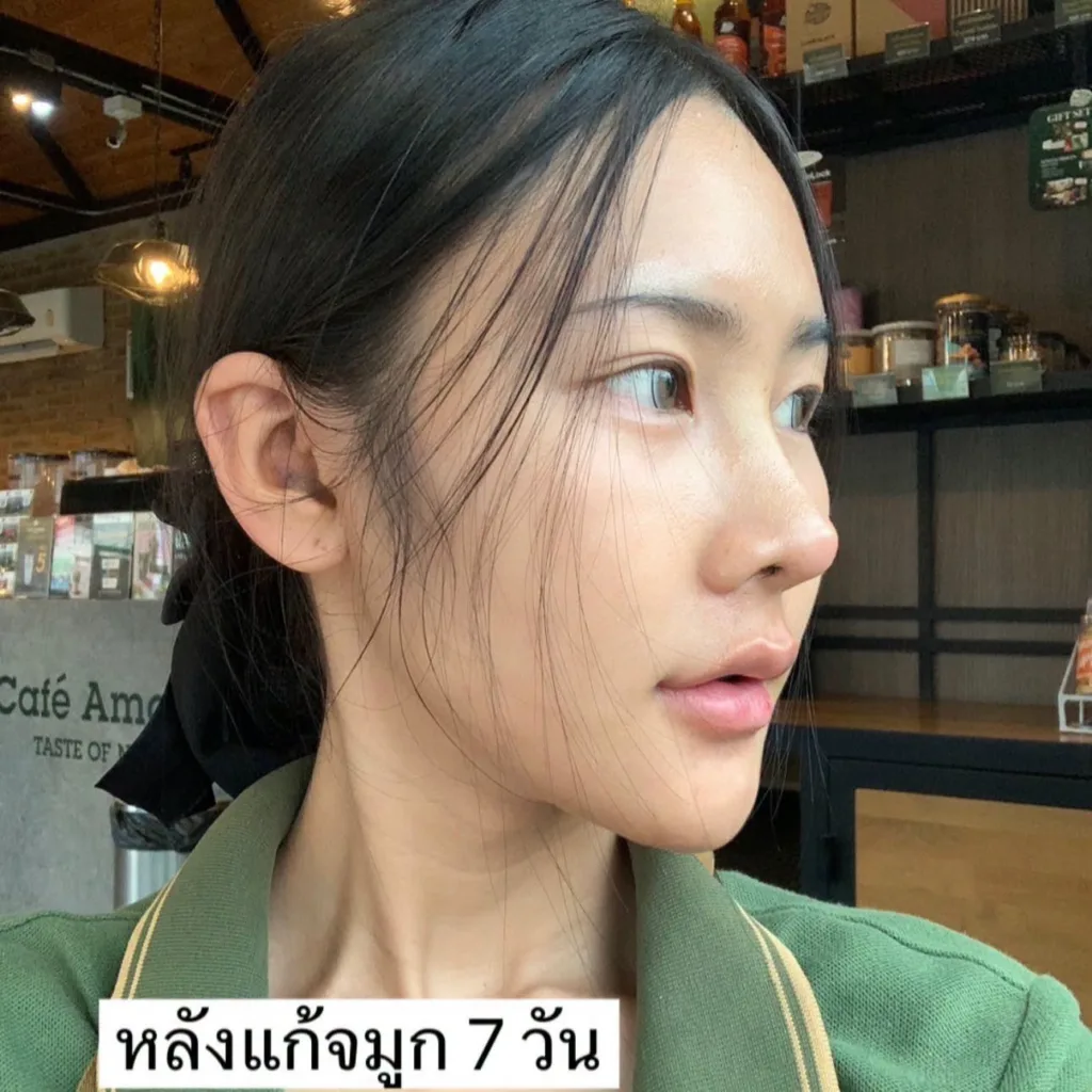 ออกแบบทรงจมูก