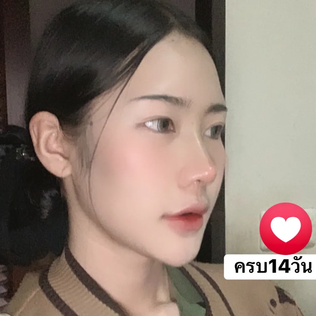 ออกแบบทรงจมูก