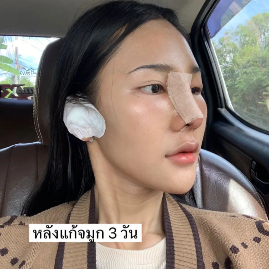 ออกแบบทรงจมูก