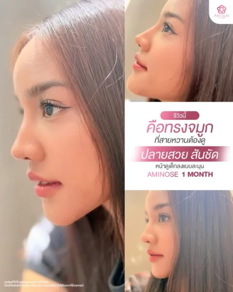 ทรงจมูกที่สวย