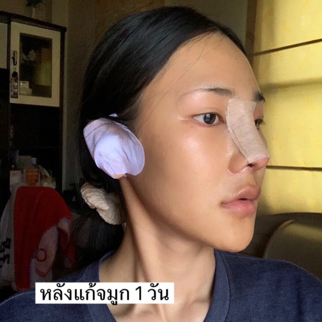 ออกแบบทรงจมูก