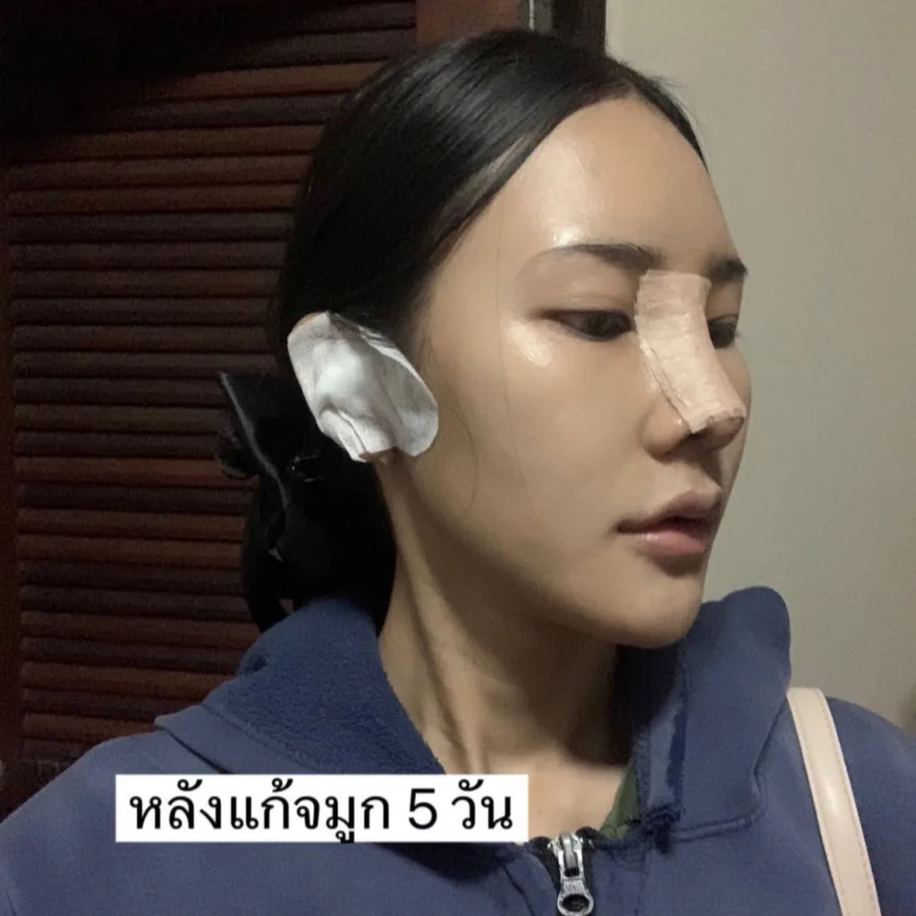 ออกแบบทรงจมูก