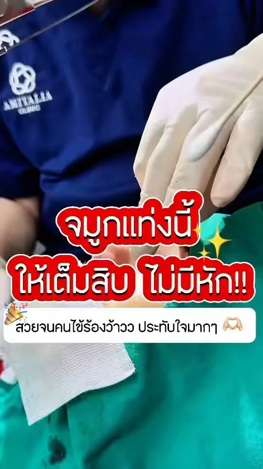 เห็นทรงจมูก