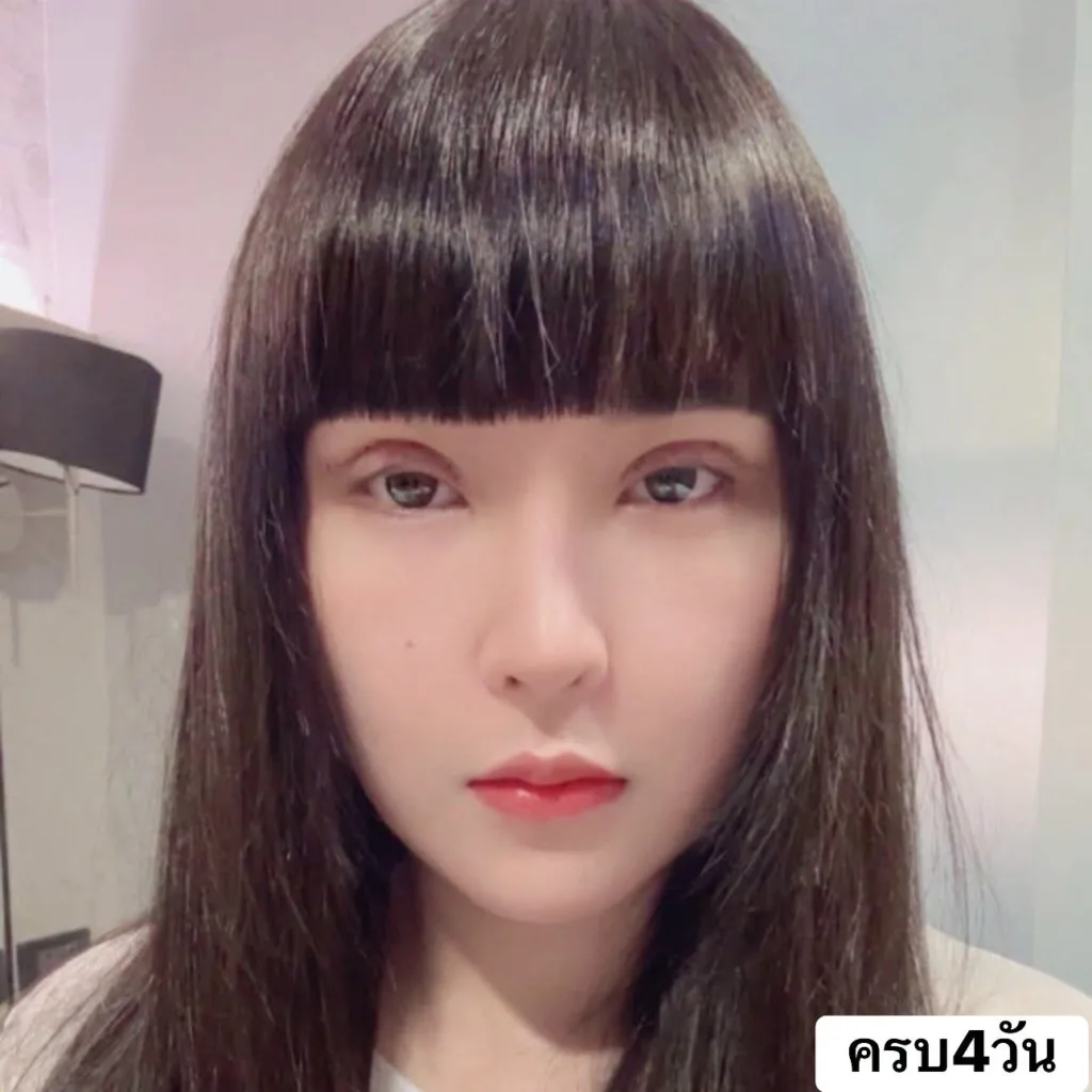 รีวิวทำตาสองชั้น