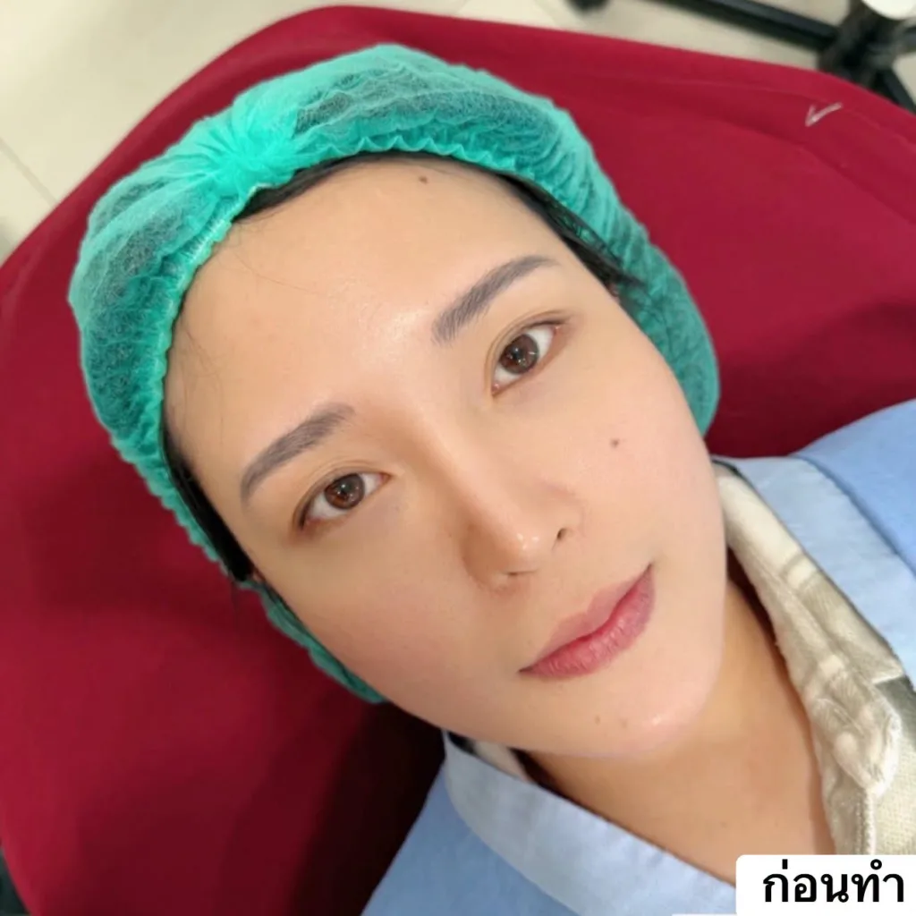 รีวิวทำตาสองชั้น
