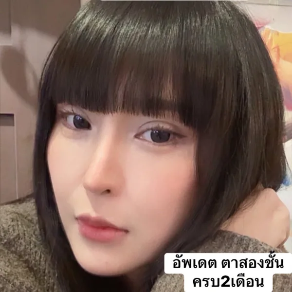 รีวิวทำตาสองชั้น