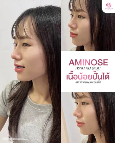 AMINOSE