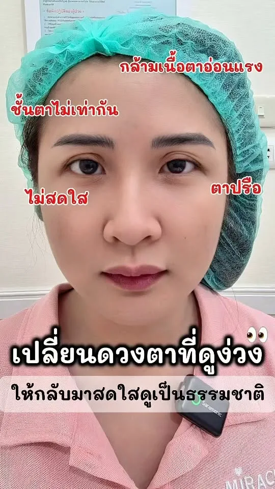 ตาพร้อมกับจมูก