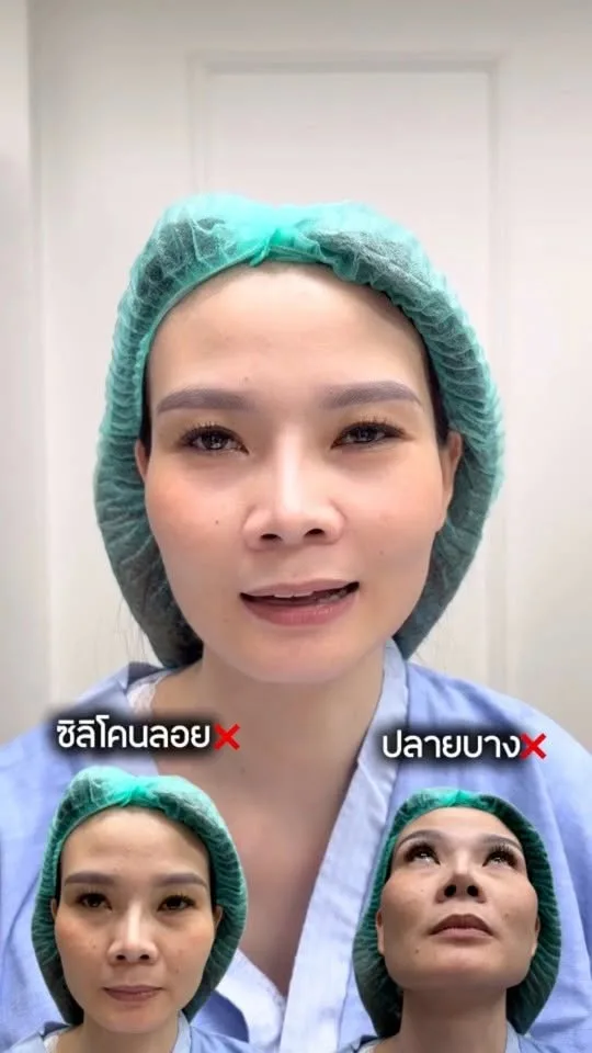แก้จมูก