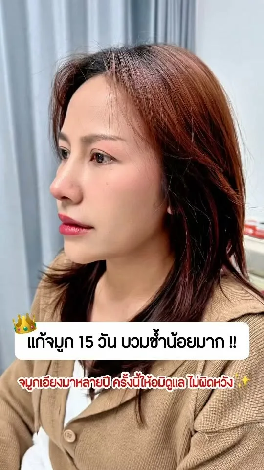 แก้จมูก