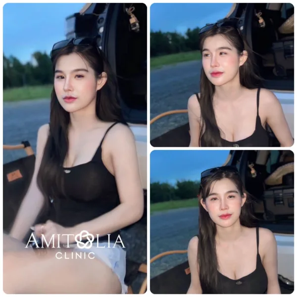 รีวิวทรงจมูก