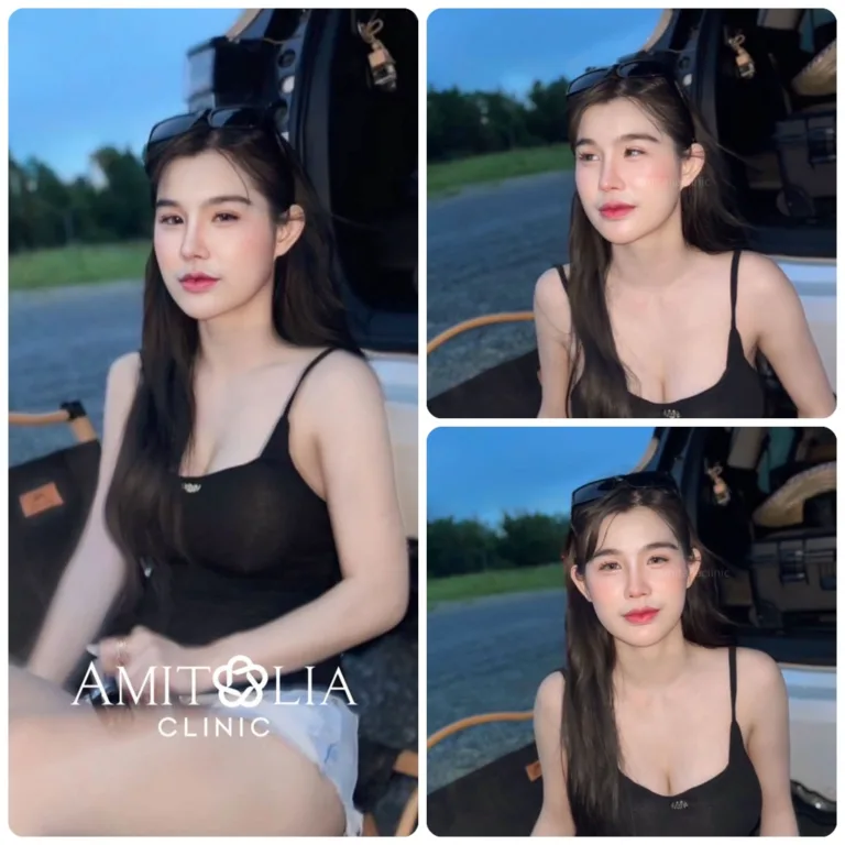 รีวิวทรงจมูก